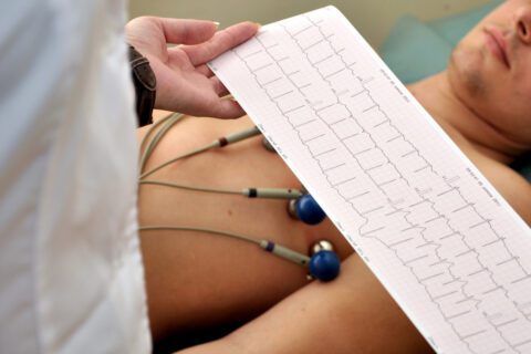 Electrocardiogramms Consultation