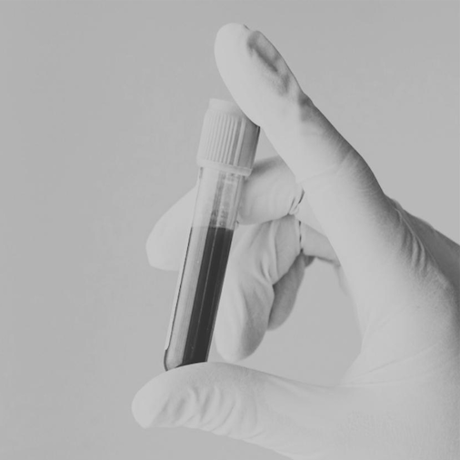 Blood tests and other laboratory tests