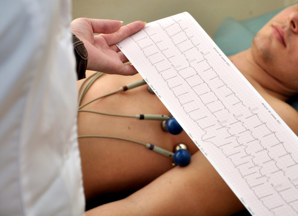 ECG consultation