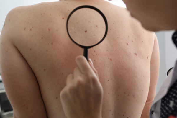 What Does a Dermatologist Do? A Complete Guide to Your First Appointment